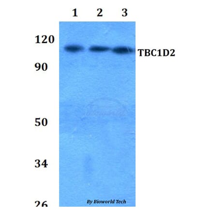Anti-TBC1D2 Antibody from Bioworld Technology (BS60814) - Antibodies.com