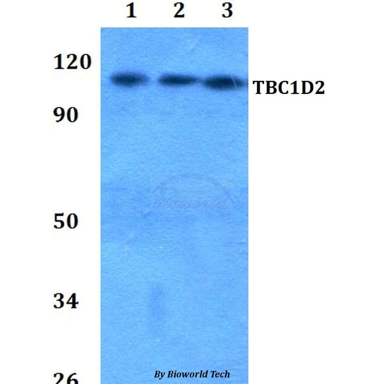 Anti-TBC1D2 Antibody from Bioworld Technology (BS60814) - Antibodies.com