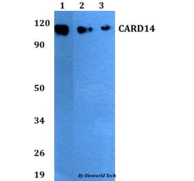 Anti-CARD14 Antibody from Bioworld Technology (BS60815) - Antibodies.com