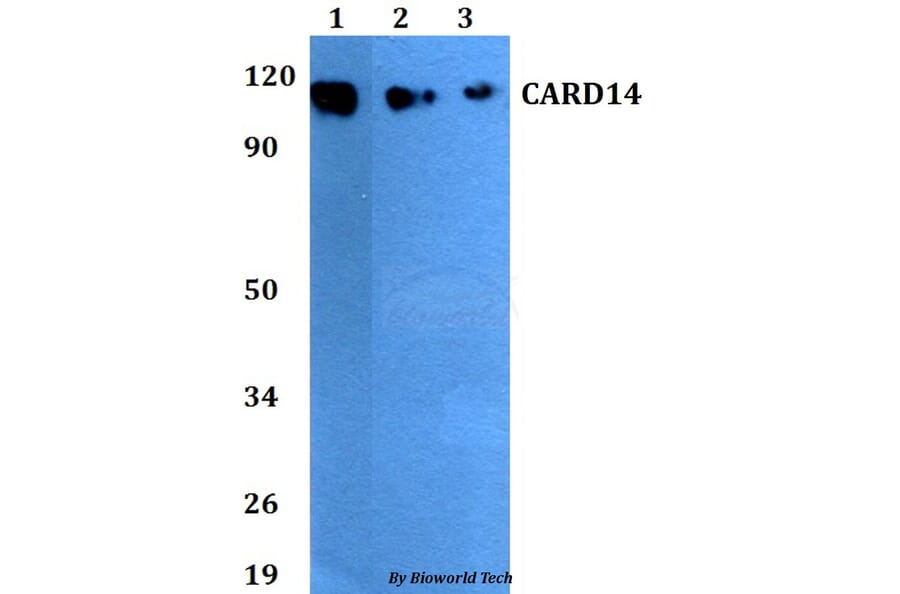 Anti-CARD14 Antibody from Bioworld Technology (BS60815) - Antibodies.com