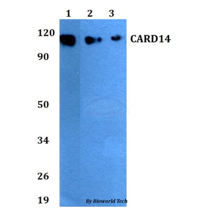 Anti-CARD14 Antibody from Bioworld Technology (BS60815) - Antibodies.com