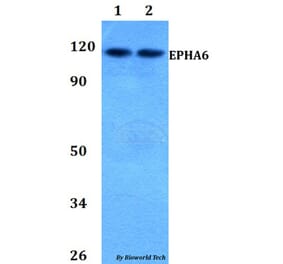 Anti-EPHA6 Antibody from Bioworld Technology (BS60816) - Antibodies.com