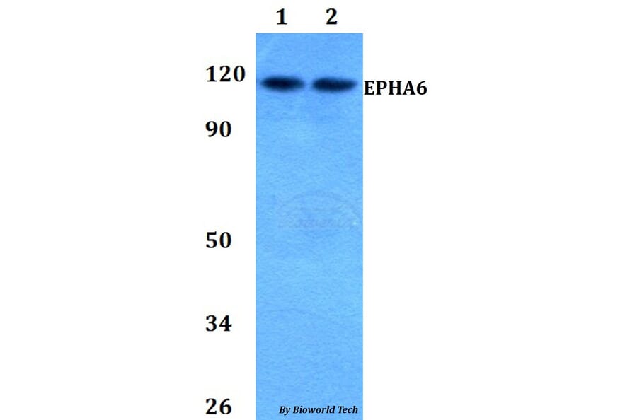 Anti-EPHA6 Antibody from Bioworld Technology (BS60816) - Antibodies.com