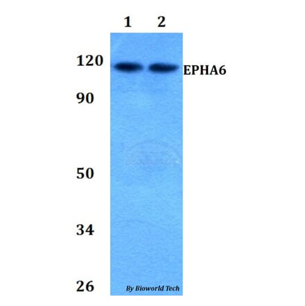 Anti-EPHA6 Antibody from Bioworld Technology (BS60816) - Antibodies.com