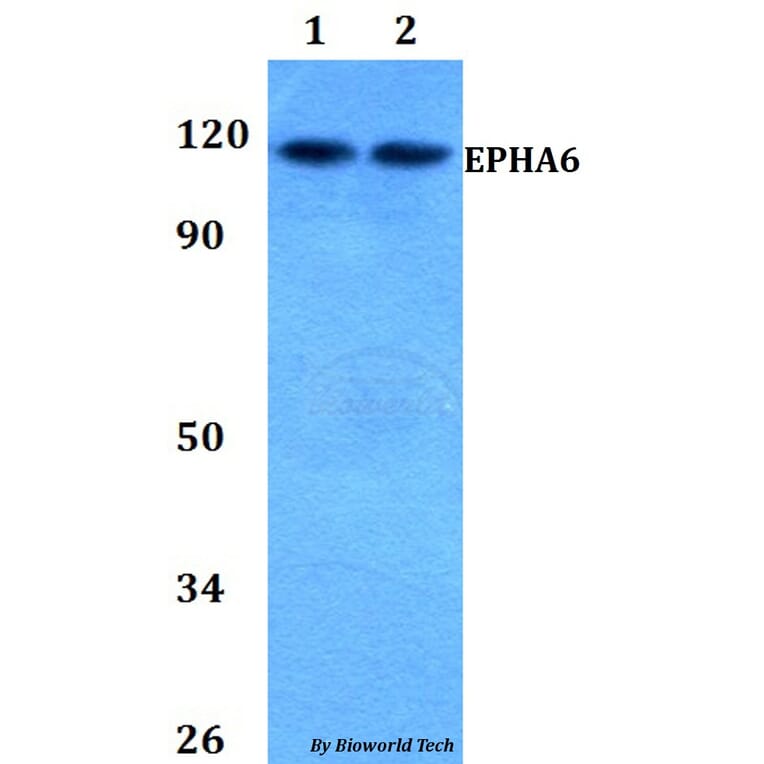 Anti-EPHA6 Antibody from Bioworld Technology (BS60816) - Antibodies.com