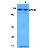 Anti-EPHA6 Antibody from Bioworld Technology (BS60816) - Antibodies.com