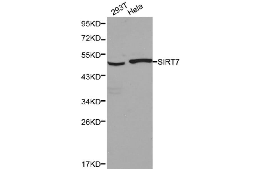 Anti-SIRT7 Antibody from Bioworld Technology (BS6082) - Antibodies.com