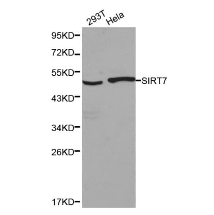 Anti-SIRT7 Antibody from Bioworld Technology (BS6082) - Antibodies.com