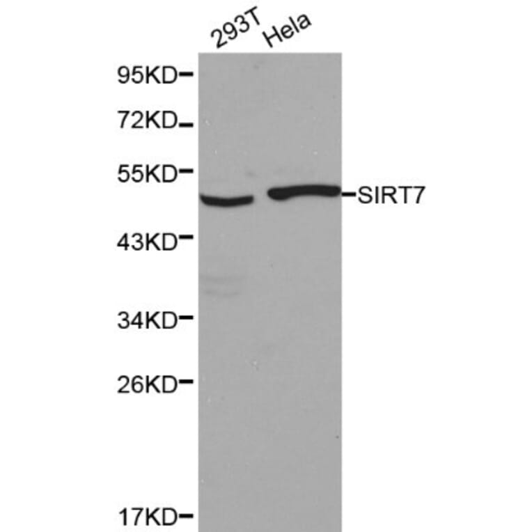 Anti-SIRT7 Antibody from Bioworld Technology (BS6082) - Antibodies.com