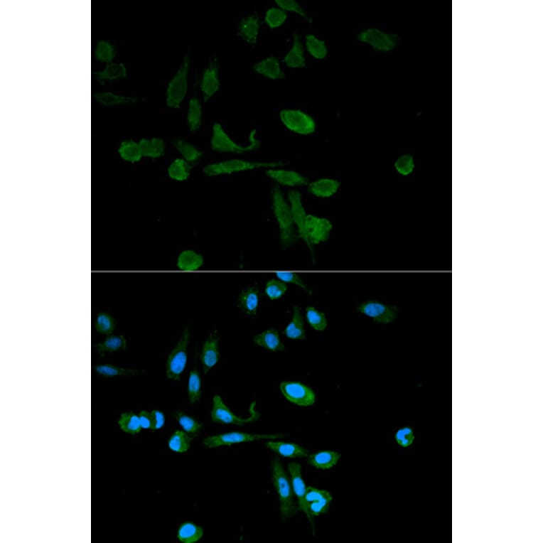 Anti-SIRT7 Antibody from Bioworld Technology (BS6082) - Antibodies.com