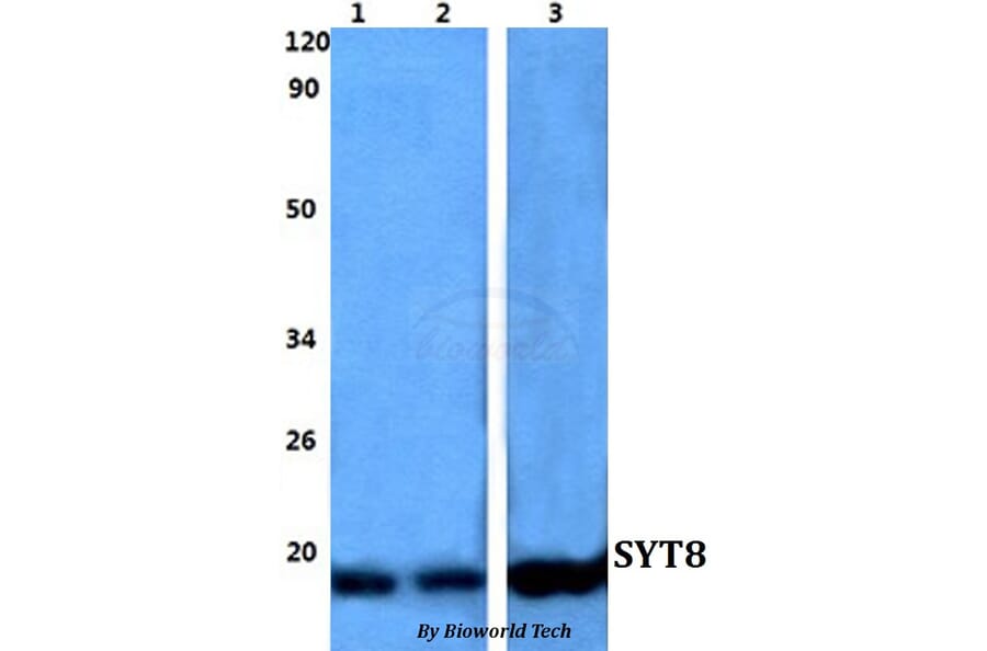 Anti-SYT8 Antibody from Bioworld Technology (BS60822) - Antibodies.com