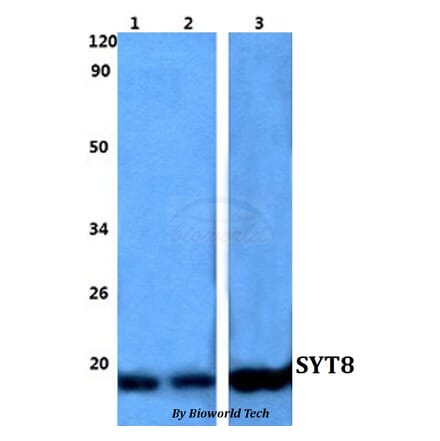 Anti-SYT8 Antibody from Bioworld Technology (BS60822) - Antibodies.com