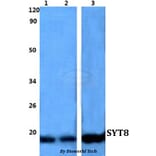 Anti-SYT8 Antibody from Bioworld Technology (BS60822) - Antibodies.com