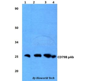 Anti-CD79B Antibody from Bioworld Technology (BS60825) - Antibodies.com