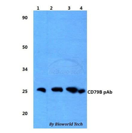 Anti-CD79B Antibody from Bioworld Technology (BS60825) - Antibodies.com