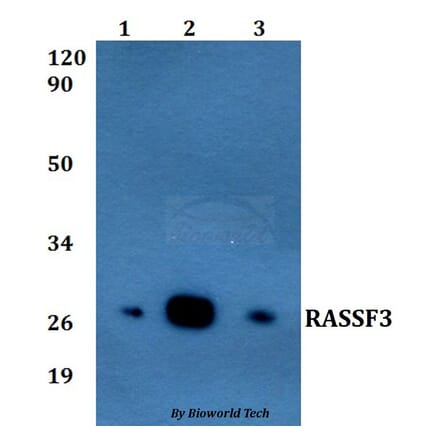 Anti-RASSF3 Antibody from Bioworld Technology (BS60826) - Antibodies.com