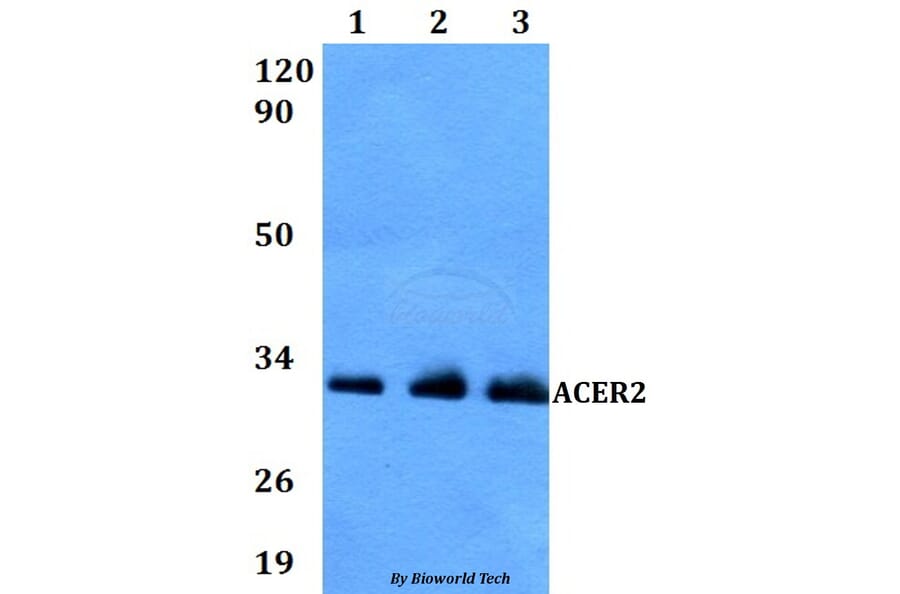 Anti-ACER2 Antibody from Bioworld Technology (BS60828) - Antibodies.com