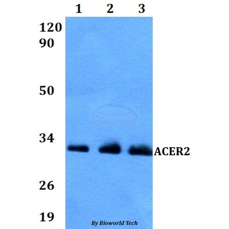 Anti-ACER2 Antibody from Bioworld Technology (BS60828) - Antibodies.com
