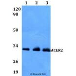 Anti-ACER2 Antibody from Bioworld Technology (BS60828) - Antibodies.com