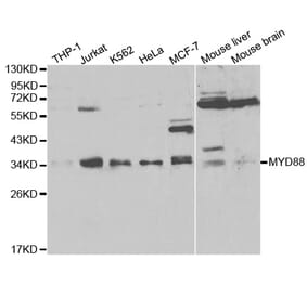 Anti-MyD88 Antibody from Bioworld Technology (BS6083) - Antibodies.com