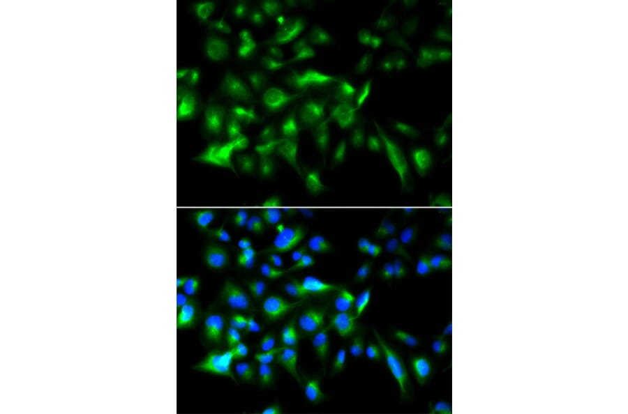 Anti-MyD88 Antibody from Bioworld Technology (BS6083) - Antibodies.com