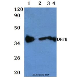 Anti-DFFB Antibody from Bioworld Technology (BS60830) - Antibodies.com
