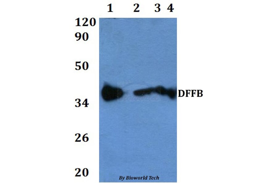 Anti-DFFB Antibody from Bioworld Technology (BS60830) - Antibodies.com