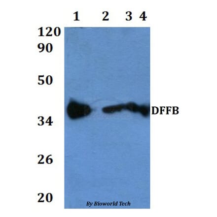 Anti-DFFB Antibody from Bioworld Technology (BS60830) - Antibodies.com