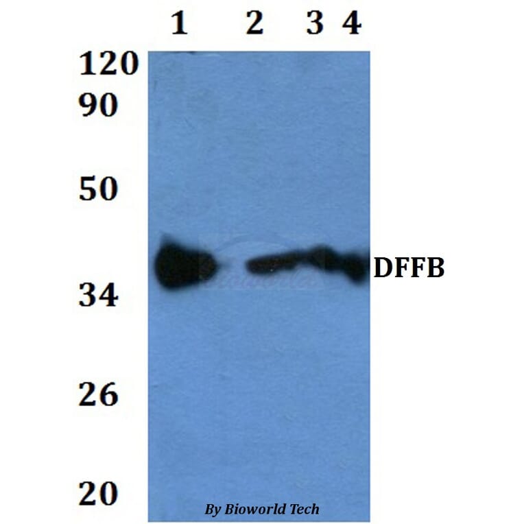 Anti-DFFB Antibody from Bioworld Technology (BS60830) - Antibodies.com