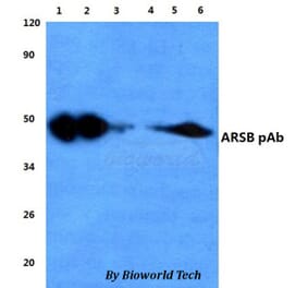 Anti-ARSB Antibody from Bioworld Technology (BS60835) - Antibodies.com