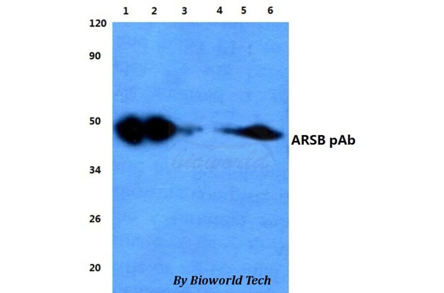 Anti-ARSB Antibody from Bioworld Technology (BS60835) - Antibodies.com