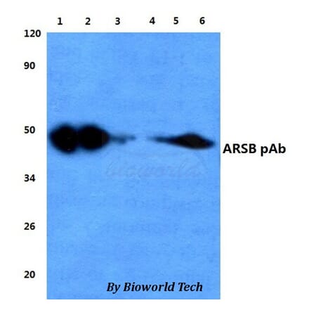 Anti-ARSB Antibody from Bioworld Technology (BS60835) - Antibodies.com