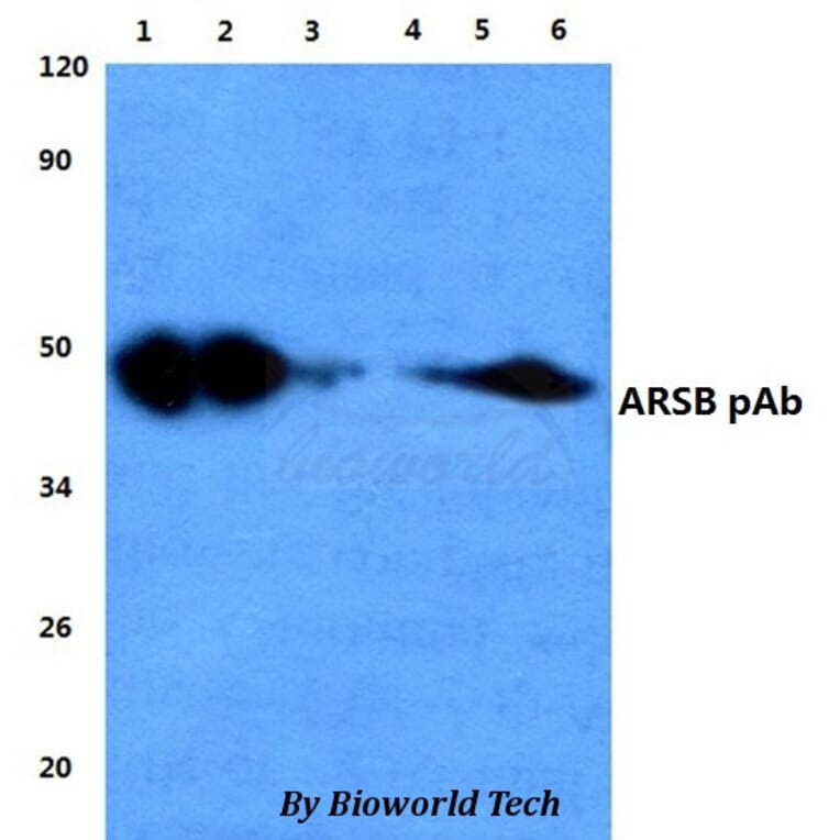 Anti-ARSB Antibody from Bioworld Technology (BS60835) - Antibodies.com