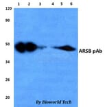 Anti-ARSB Antibody from Bioworld Technology (BS60835) - Antibodies.com