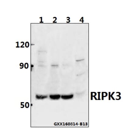 Anti-RIPK3 Antibody from Bioworld Technology (BS60836) - Antibodies.com