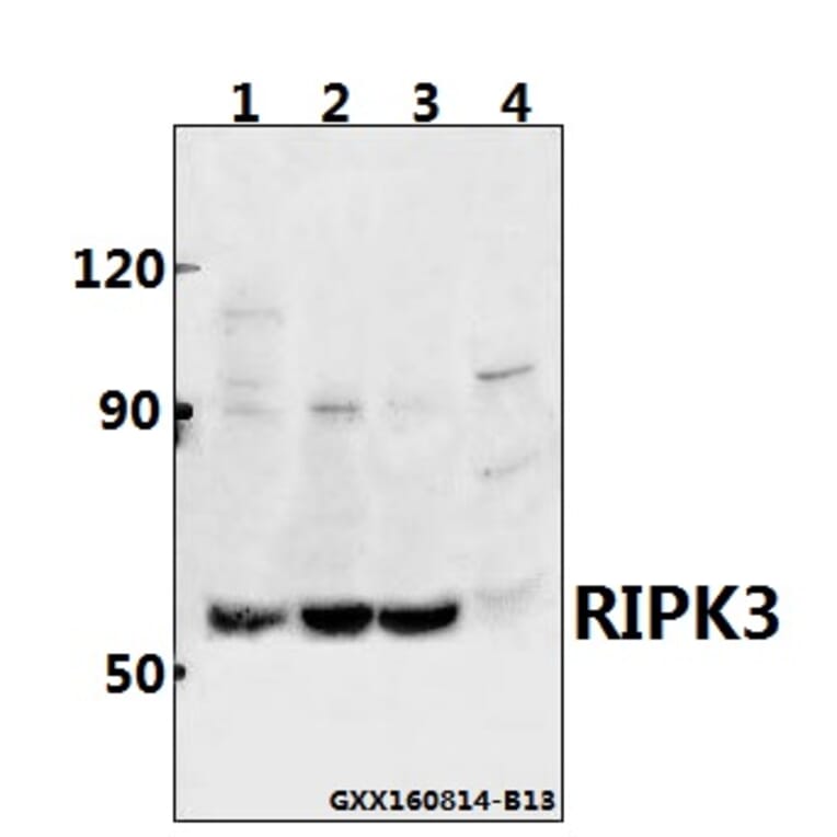 Anti-RIPK3 Antibody from Bioworld Technology (BS60836) - Antibodies.com