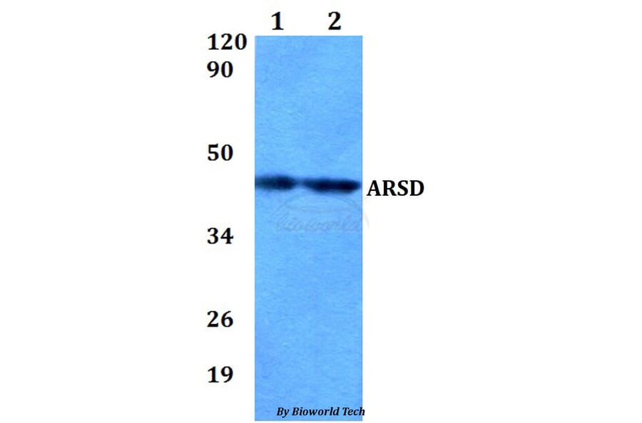 Anti-ARSD Antibody from Bioworld Technology (BS60837) - Antibodies.com