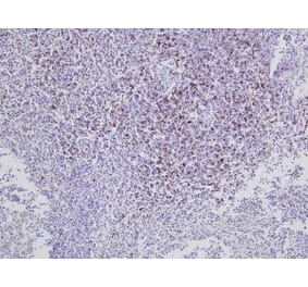 Immunohistochemistry - Anti-CD8 Antibody [CC63] (A280059) - Antibodies.com