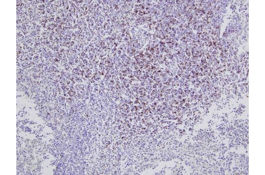Immunohistochemistry - Anti-CD8 Antibody [CC63] (A280059) - Antibodies.com
