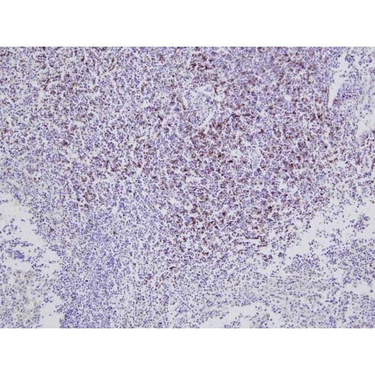 Immunohistochemistry - Anti-CD8 Antibody [CC63] (A280059) - Antibodies.com