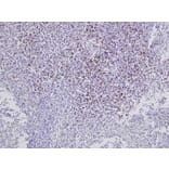 Immunohistochemistry - Anti-CD8 Antibody [CC63] (A280059) - Antibodies.com
