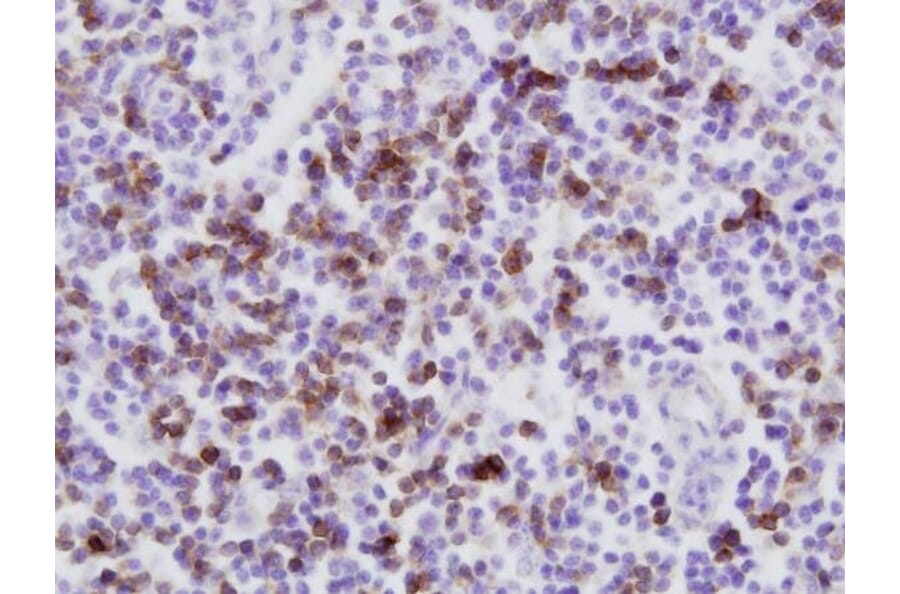 Immunohistochemistry - Anti-CD8 Antibody [CC63] (A280059) - Antibodies.com