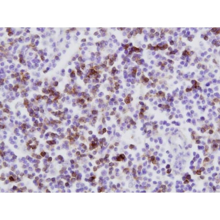 Immunohistochemistry - Anti-CD8 Antibody [CC63] (A280059) - Antibodies.com