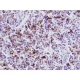 Immunohistochemistry - Anti-CD8 Antibody [CC63] (A280059) - Antibodies.com