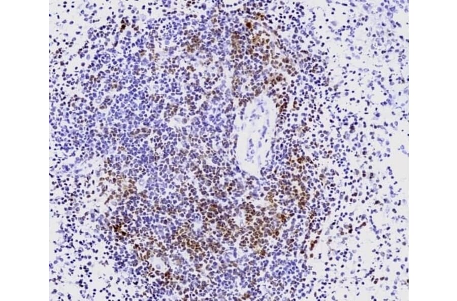 Immunohistochemistry - Anti-CD3 epsilon Antibody [CD3-12] (A280087) - Antibodies.com