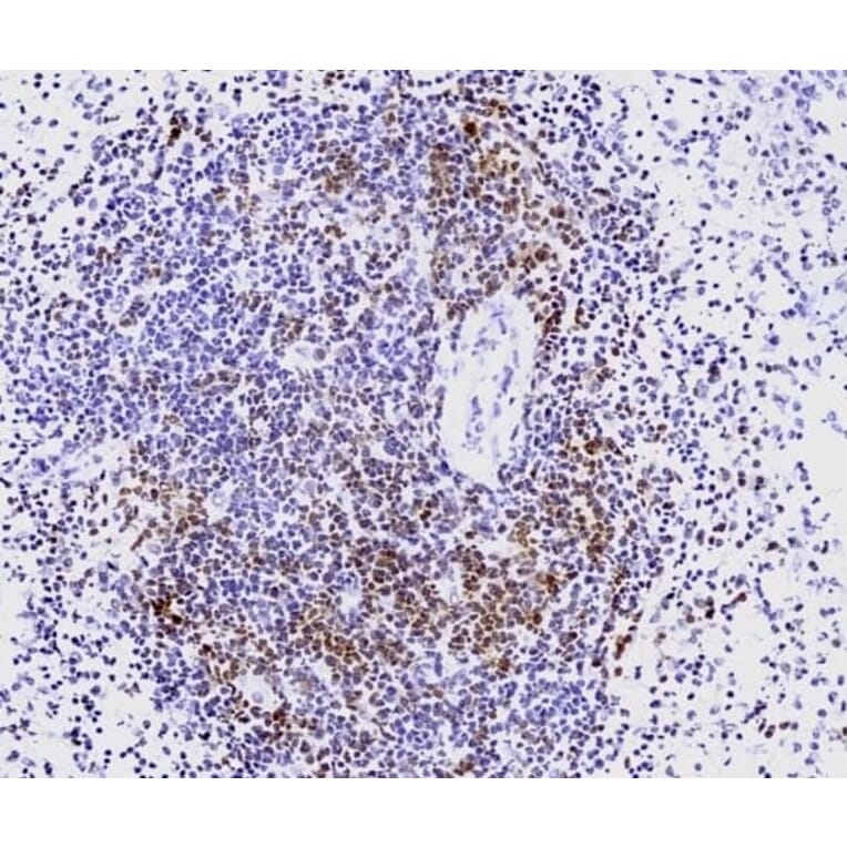Immunohistochemistry - Anti-CD3 epsilon Antibody [CD3-12] (A280087) - Antibodies.com