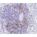 Immunohistochemistry - Anti-CD3 epsilon Antibody [CD3-12] (A280087) - Antibodies.com