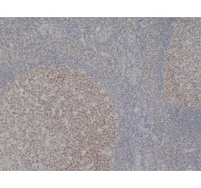 Immunohistochemistry - Anti-MCM2 Antibody [CRCT2.1] (A280143) - Antibodies.com