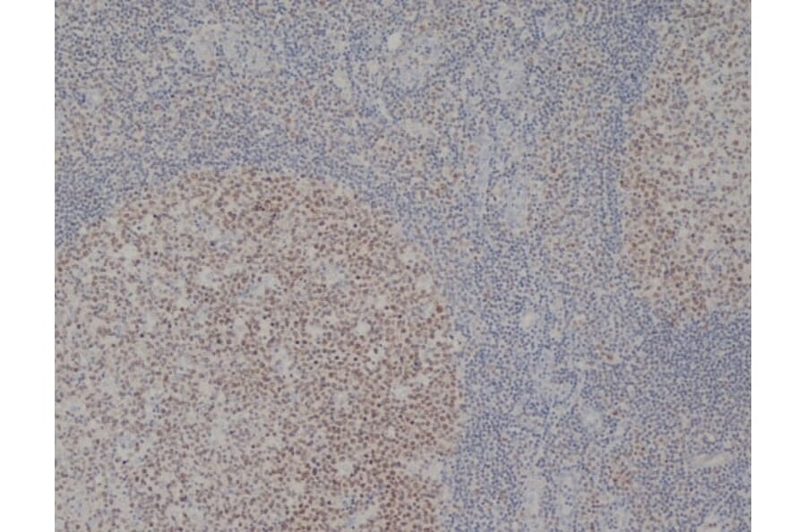 Immunohistochemistry - Anti-MCM2 Antibody [CRCT2.1] (A280143) - Antibodies.com