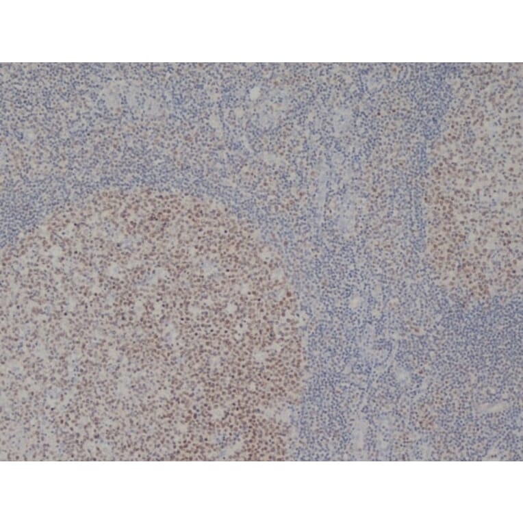 Immunohistochemistry - Anti-MCM2 Antibody [CRCT2.1] (A280143) - Antibodies.com